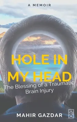 Das Loch in meinem Kopf: Der Segen einer traumatischen Hirnverletzung - Hole in My Head: The Blessing of a Traumatic Brain Injury