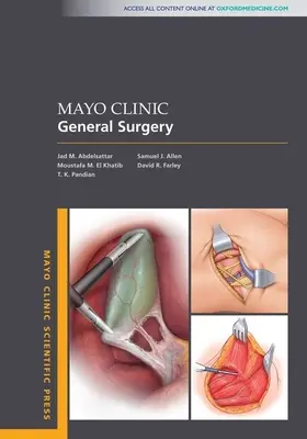 Mayo Clinic Allgemeine Chirurgie - Mayo Clinic General Surgery
