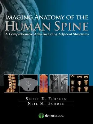 Bildgebende Anatomie der menschlichen Wirbelsäule: Ein umfassender Atlas einschließlich angrenzender Strukturen - Imaging Anatomy of the Human Spine: A Comprehensive Atlas Including Adjacent Structures