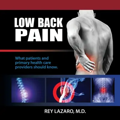 Niedrige Rückenschmerzen, was Patienten und Primärversorger wissen sollten - Low Back Pain, What patients and primary care health care providers should know