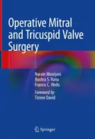 Operative Mitral- und Trikuspidalklappenchirurgie - Operative Mitral and Tricuspid Valve Surgery