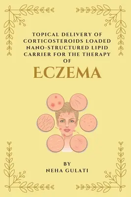 Topische Verabreichung von mit Kortikosteroiden beladenen nanostrukturierten Lipidträgern für die Therapie von Ekzemen - Topical Delivery of Corticosteroids Loaded Nanostructured Lipid Carrier for the Therapy of Eczema