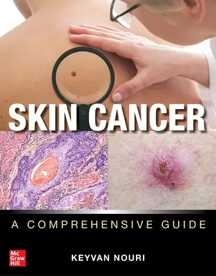 Hautkrebs: Ein umfassender Leitfaden - Skin Cancer: A Comprehensive Guide