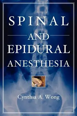 Spinal- und Epiduralanästhesie - Spinal and Epidural Anesthesia