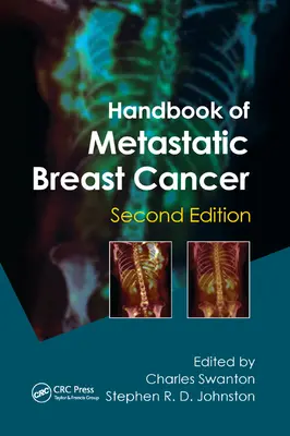Handbuch des metastasierenden Brustkrebses - Handbook of Metastatic Breast Cancer