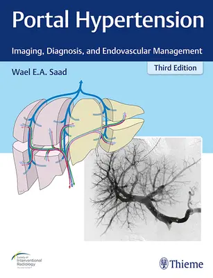 Portale Hypertension: Bildgebung, Diagnose und endovaskuläres Management - Portal Hypertension: Imaging, Diagnosis, and Endovascular Management