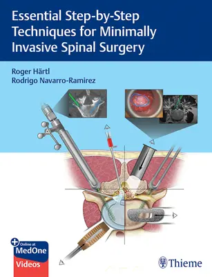 Wesentliche Schritt-für-Schritt-Techniken für die minimal-invasive Wirbelsäulenchirurgie - Essential Step-By-Step Techniques for Minimally Invasive Spinal Surgery