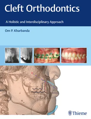 Spalt-Kieferorthopädie: Ein ganzheitlicher und interdisziplinärer Ansatz - Cleft Orthodontics: A Holistic and Interdisciplinary Approach