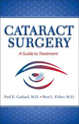 Katarakt-Chirurgie: Ein Leitfaden zur Behandlung - Cataract Surgery: A Guide to Treatment