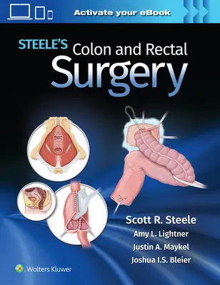 Steele's Dickdarm- und Enddarmchirurgie - Steele's Colon and Rectal Surgery