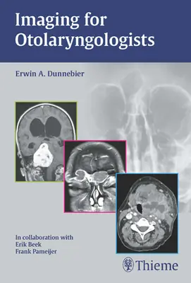 Bildgebung für Otolaryngologen - Imaging for Otolaryngologists