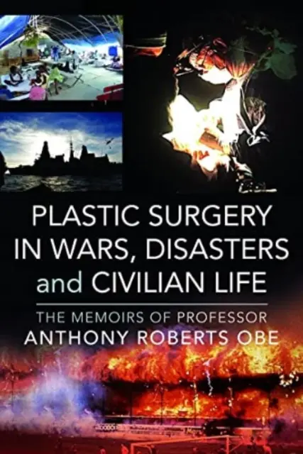 Plastische Chirurgie in Kriegen, Katastrophen und im zivilen Leben: Die Memoiren von Professor Anthony Roberts OBE - Plastic Surgery in Wars, Disasters and Civilian Life: The Memoirs of Professor Anthony Roberts OBE