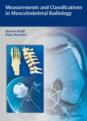 Messungen und Klassifizierungen in der muskuloskelettalen Radiologie - Measurements and Classifications in Musculoskeletal Radiology
