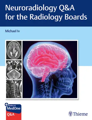 Neuroradiologie - Fragen und Antworten für die Radiologie-Prüfungen - Neuroradiology Q&A for the Radiology Boards