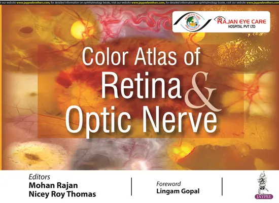 Farbatlas der Netzhaut und des Sehnervs - Color Atlas of Retina & Optic Nerve