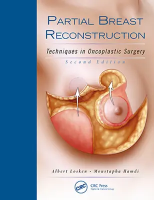 Partielle Brustrekonstruktion: Techniken der onkoplastischen Chirurgie - Partial Breast Reconstruction: Techniques in Oncoplastic Surgery
