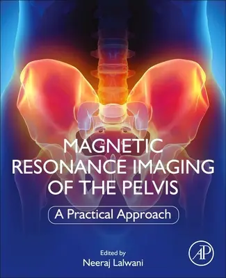 Magnetresonanztomographie des Beckens: Eine praktische Herangehensweise - Magnetic Resonance Imaging of the Pelvis: A Practical Approach