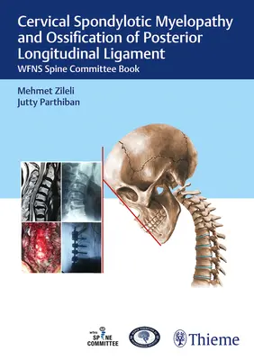 Zervikale spondylotische Myelopathie und Verknöcherung des posterioren Längsbandes: Buch des Wfns-Wirbelsäulenausschusses - Cervical Spondylotic Myelopathy and Ossification of Posterior Longitudinal Ligament: Wfns Spine Committee Book