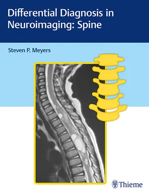 Differentialdiagnose in der Neurobildgebung: Wirbelsäule - Differential Diagnosis in Neuroimaging: Spine