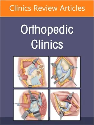 Tumors, eine Ausgabe von Orthopedic Clinics: Band 54-1 - Tumors, an Issue of Orthopedic Clinics: Volume 54-1