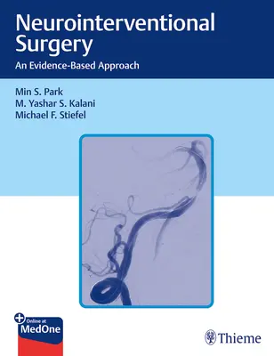 Neurointerventionelle Chirurgie: Ein evidenzbasierter Ansatz - Neurointerventional Surgery: An Evidence-Based Approach