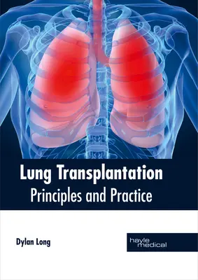 Lungentransplantation: Grundsätze und Praxis - Lung Transplantation: Principles and Practice