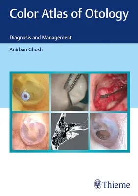 Farbatlas der Otologie: Diagnose und Management - Color Atlas of Otology: Diagnosis and Management