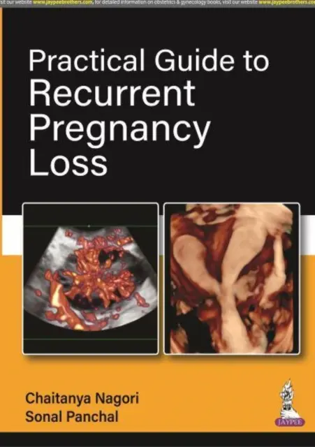 Praktischer Leitfaden für wiederholte Schwangerschaftsverluste - Practical Guide to Recurrent Pregnancy Loss