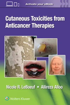Hautreaktionen bei Krebstherapien - Cutaneous Reactions from Anti-Cancer Therapies