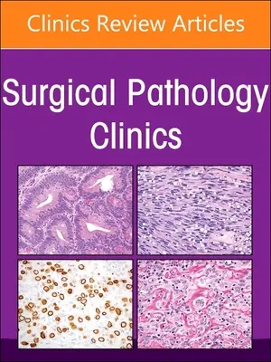 Endokrine Pathologie, eine Ausgabe von Surgical Pathology Clinics: Band 16-1 - Endocrine Pathology, an Issue of Surgical Pathology Clinics: Volume 16-1