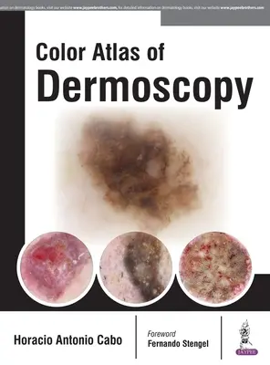 Farbatlas der Dermoskopie - Color Atlas of Dermoscopy