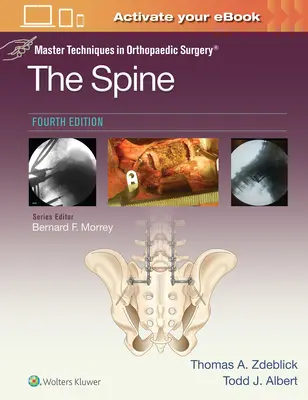 Meistertechniken in der orthopädischen Chirurgie: Die Wirbelsäule - Master Techniques in Orthopaedic Surgery: The Spine