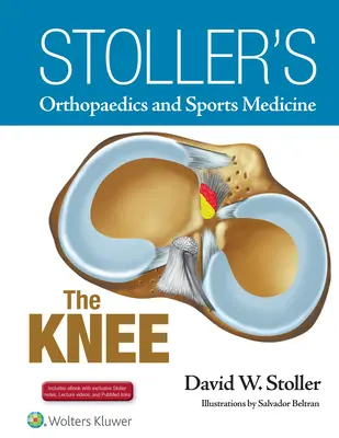 Stoller's Orthopädie und Sportmedizin: Das Knie: Enthält Stoller-Vorlesungsvideos und Stoller-Notizen - Stoller's Orthopaedics and Sports Medicine: The Knee: Includes Stoller Lecture Videos and Stoller Notes