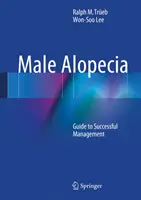 Alopezie bei Männern: Leitfaden für ein erfolgreiches Management - Male Alopecia: Guide to Successful Management