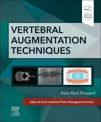 Vertebrale Augmentationstechniken - Vertebral Augmentation Techniques