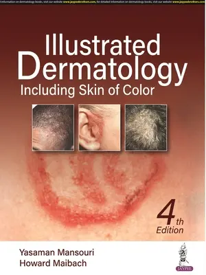 Illustrierte Dermatologie - Einschließlich der Haut der Farben - Illustrated Dermatology - Including Skin of Colour