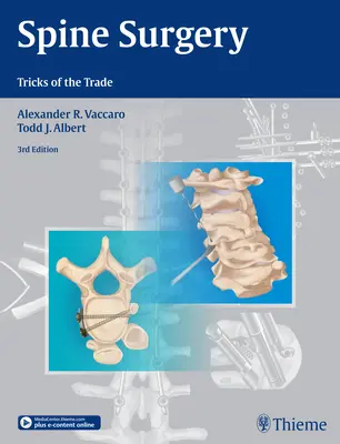 Wirbelsäulenchirurgie: Tricks des Handwerks - Spine Surgery: Tricks of the Trade