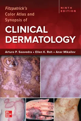 Fitzpatrick's Color Atlas and Synopsis of Clinical Dermatology, Neunte Ausgabe - Fitzpatrick's Color Atlas and Synopsis of Clinical Dermatology, Ninth Edition