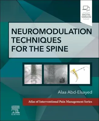 Neuromodulationstechniken für die Wirbelsäule: Ein Band der Atlas of Interventional Pain Management Serie - Neuromodulation Techniques for the Spine: A Volume in the Atlas of Interventional Pain Management Series