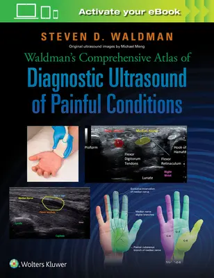 Waldmans umfassender Atlas des diagnostischen Ultraschalls bei schmerzhaften Zuständen - Waldman's Comprehensive Atlas of Diagnostic Ultrasound of Painful Conditions