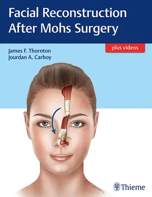 Gesichtsrekonstruktion nach Mohs-Chirurgie - Facial Reconstruction After Mohs Surgery