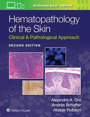 Hämatopathologie der Haut: Klinische und pathologische Betrachtung - Hematopathology of the Skin: Clinical & Pathological Approach