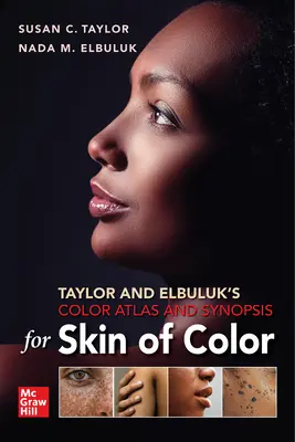 Taylor und Elbuluks Farbatlas und Synopse für farbige Haut - Taylor and Elbuluk's Color Atlas and Synopsis for Skin of Color