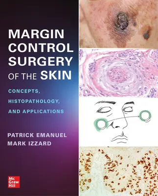 Margin Control Surgery of the Skin: Konzepte, Histopathologie und Anwendungen - Margin Control Surgery of the Skin: Concepts, Histopathology, and Applications