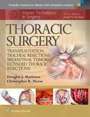 Master-Techniken in der Chirurgie: Thoraxchirurgie: Transplantation, Trachealresektionen, Mediastinaltumore, erweiterte Thoraxresektionen - Master Techniques in Surgery: Thoracic Surgery: Transplantation, Tracheal Resections, Mediastinal Tumors, Extended Thoracic Resections