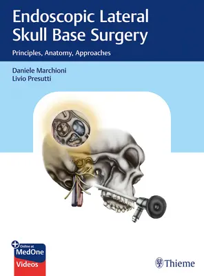 Endoskopische seitliche Schädelbasischirurgie: Prinzipien, Anatomie, Vorgehensweisen - Endoscopic Lateral Skull Base Surgery: Principles, Anatomy, Approaches