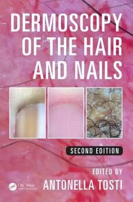 Dermoskopie der Haare und Nägel - Dermoscopy of the Hair and Nails