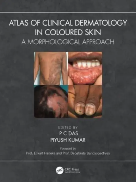 Atlas der klinischen Dermatologie bei farbiger Haut: Ein morphologischer Ansatz - Atlas of Clinical Dermatology in Coloured Skin: A Morphological Approach