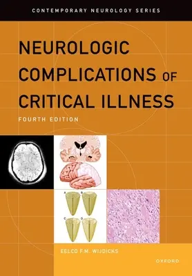 Neurologische Komplikationen bei kritischer Krankheit - Neurologic Complications of Critical Illness