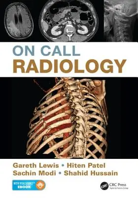 Radiologie auf Abruf - On Call Radiology